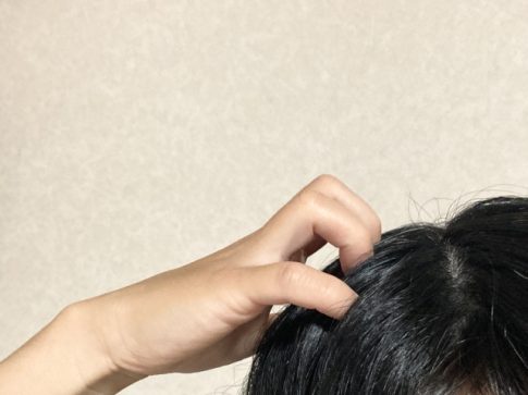 頭皮　かゆみ
