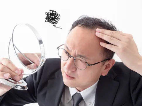 薄毛悩み