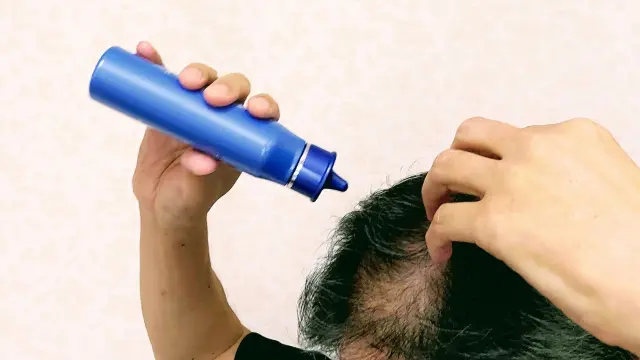 ミノキシジル外用薬を頭皮に塗布するイメージ