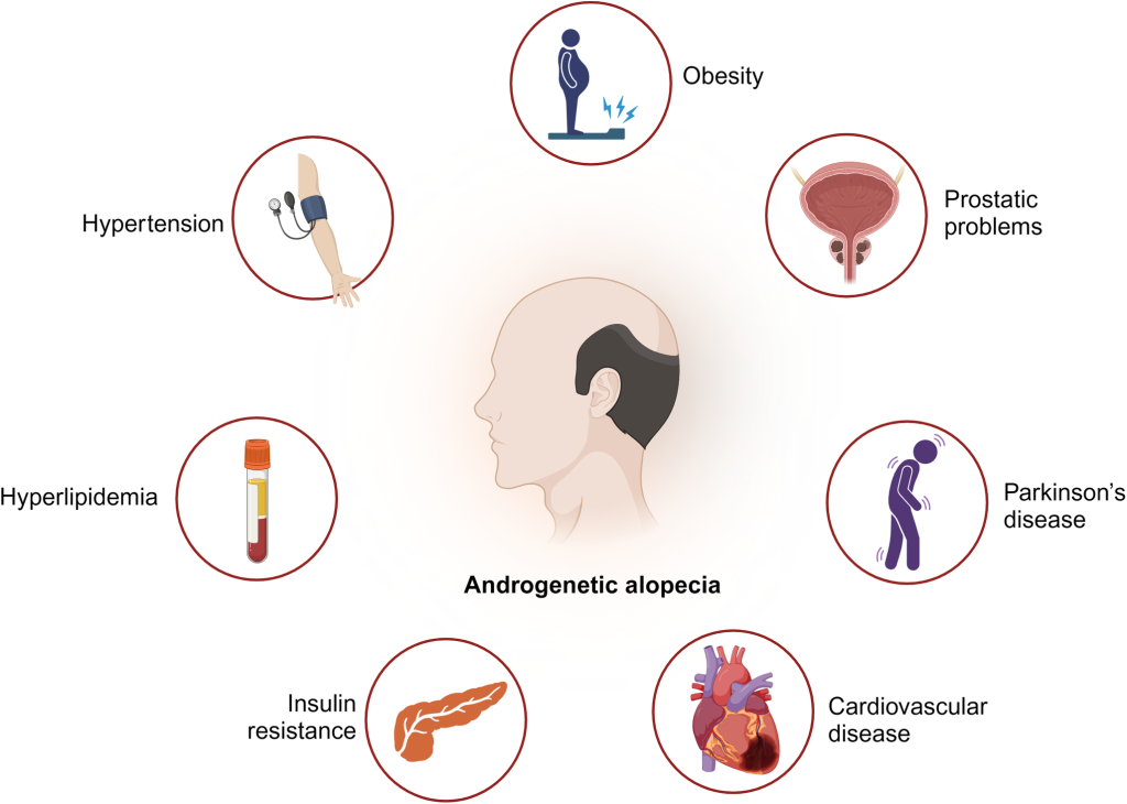Factors associated with early-onset androgenetic alopecia: A scoping review