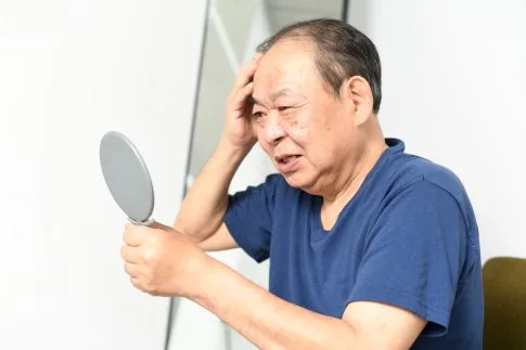 薄毛