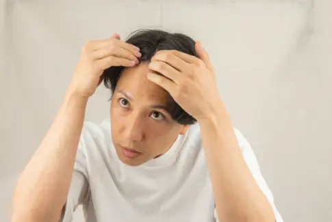 髪の生え際をォにする男性