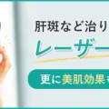 レーザートーニング
