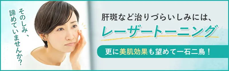 激光调色用于难以治愈的斑点,例如黄褐斑