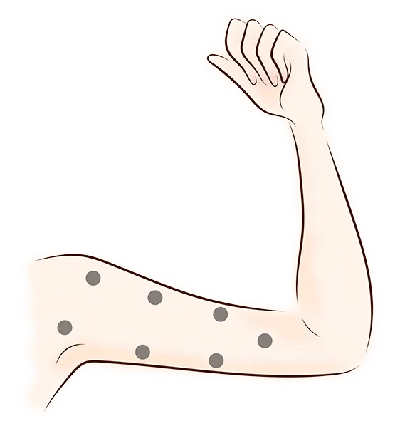 Arm