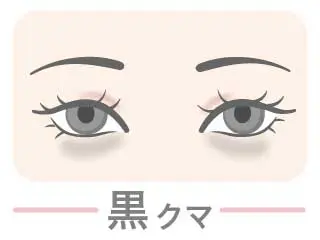 クマの種類_黒クマ