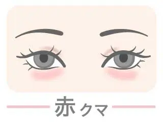 クマの種類_赤クマ