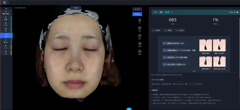 10年後の美肌を作る3D肌診断（スキンアナライザー）｜ヒロクリニック
