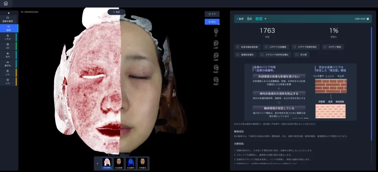 10年後の美肌を作る3D肌診断（スキンアナライザー）｜ヒロクリニック