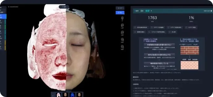 3Dスキンアナライザーの解析画面