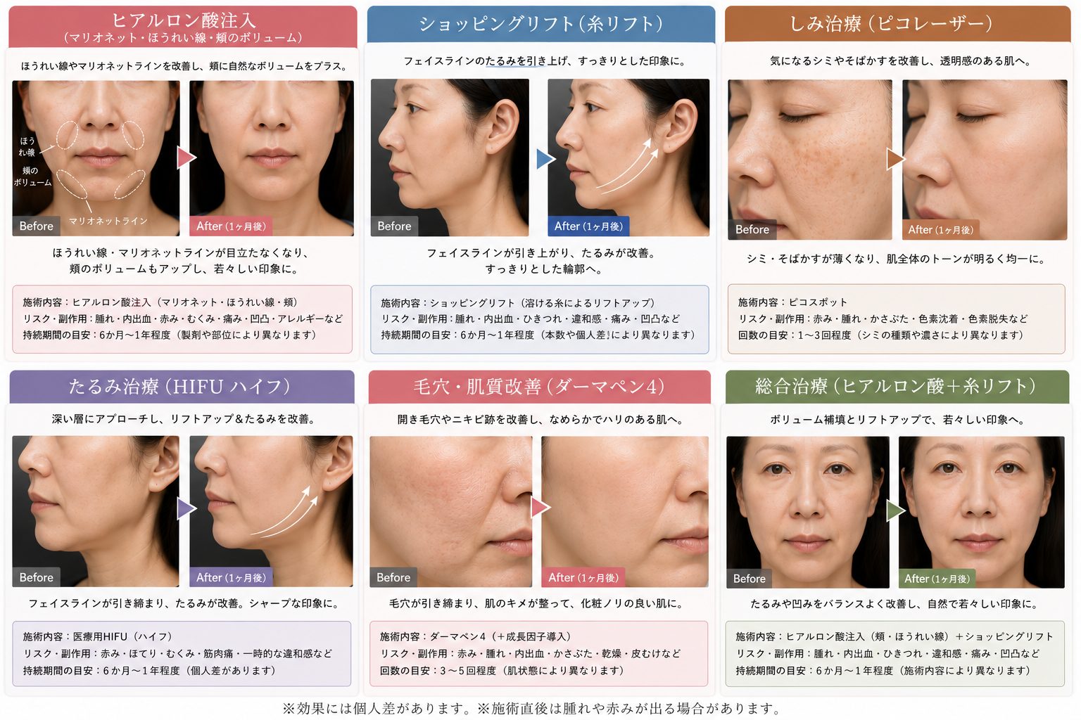 人気施術（ヒアルロン酸注入・ショッピングリフト・ピコレーザー・HIFU・ダーマペン4など）の施術前後の症例写真