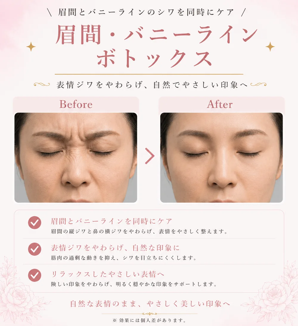 ボツリヌストキシン注射の症例写真（眉間・バニーラインのしわ）｜ヒロクリニック美容皮膚科