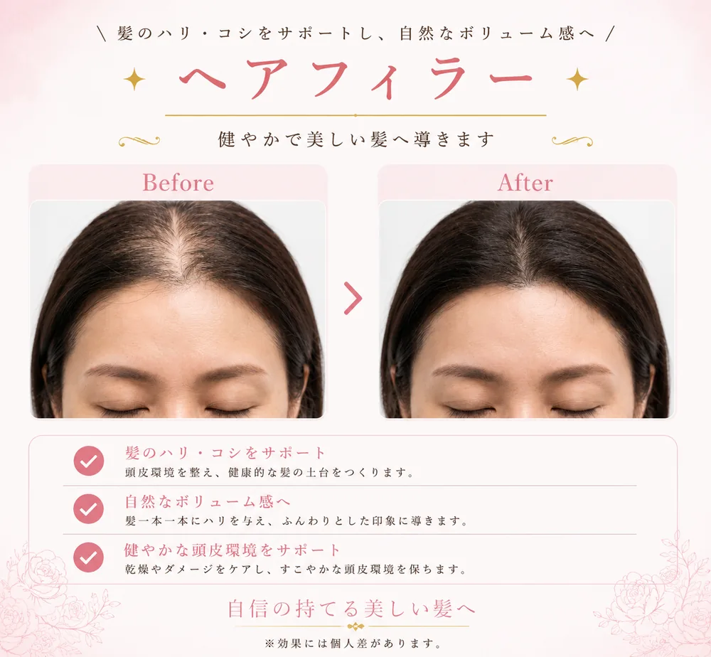Dr.CYJ ヘアフィラーの症例写真（髪のハリ・ボリューム）｜ヒロクリニック美容皮膚科