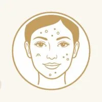 ニキビのある顔を描いた線画のイラスト