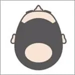 男性型脱毛症・AGA