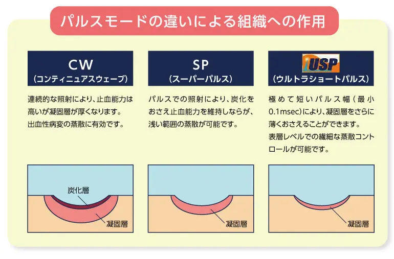 パルスモードの違いによる組織への作用