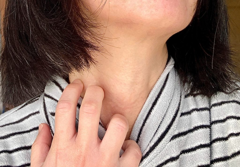 
首をかく・掻きむしる手元のクローズアップ