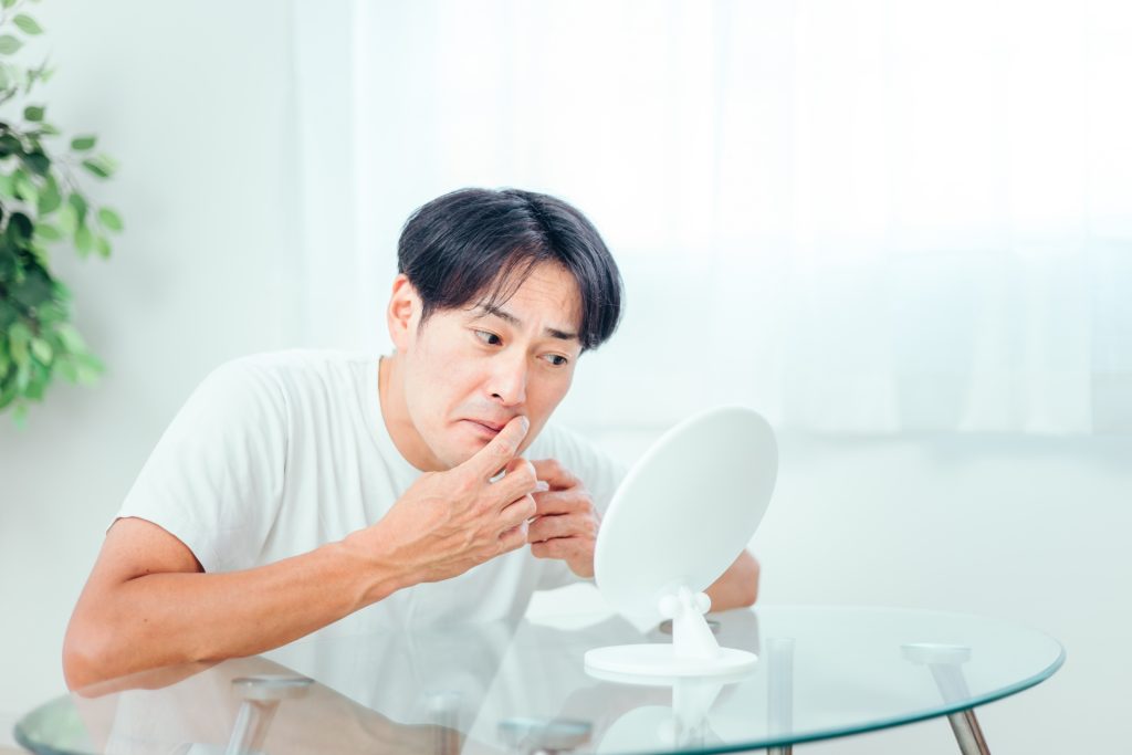 肌に悩む男性(ニキビ)