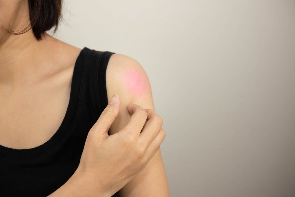 肩がかゆい女性