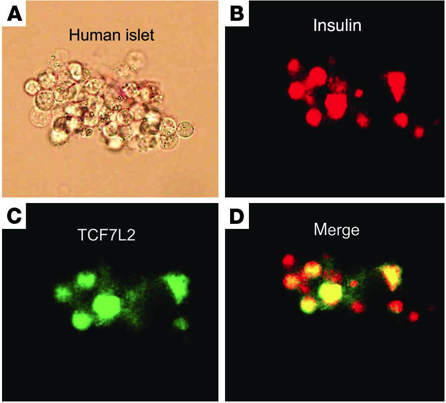 Figure 5. Colocalization of TCF7L2 expression with insulin in pancreatic islets(A–D). 