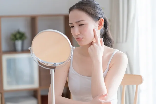 ニキビ