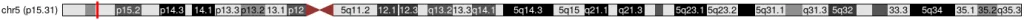 SRD5A1