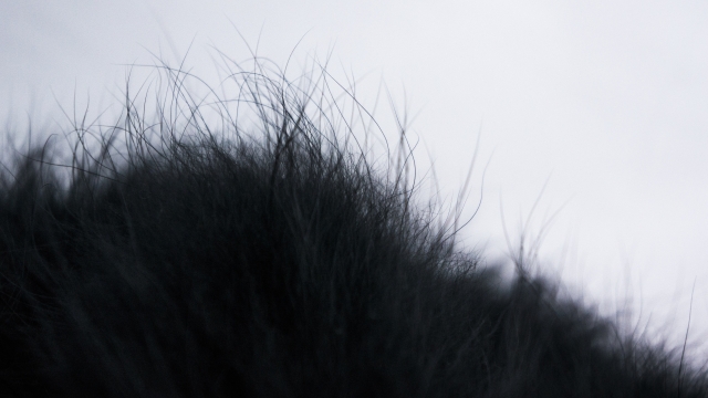 短くカットされた黒髪の頭皮を接写した画像。健康的な毛髪の質感や毛流れ、毛包の密度がわかるテクスチャーで、植毛後の自然な仕上がりや毛髪の成長イメージを伝えるビジュアル。