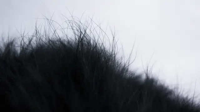 短くカットされた黒髪の頭皮を接写した画像。健康的な毛髪の質感や毛流れ、毛包の密度がわかるテクスチャーで、植毛後の自然な仕上がりや毛髪の成長イメージを伝えるビジュアル。