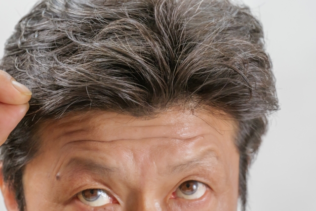 50代以上の男性が少し困惑した表情で上を見上げ、額には心配によるシワが刻まれている。指先で白髪交じりの細く乾燥した髪をつまみ、毛髪の薄さやパサつきを感じている様子。