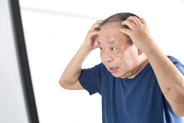 50代男性が鏡の前で、自身の進行する薄毛と肌の老化に驚きと落胆の表情を浮かべている。これは加齢のせいなのか？以前のように改善できる方法はあるのか――そんな疑問を抱く瞬間を捉えた一枚。