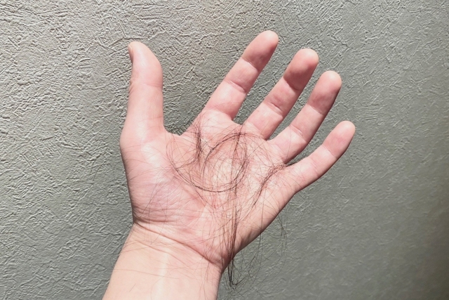手のひらに抜け落ちた髪の毛が乗っている男性のイメージ。脱毛や抜け毛の悩み、毛髪サイクルによる自然な髪の減少を象徴するストック写真。