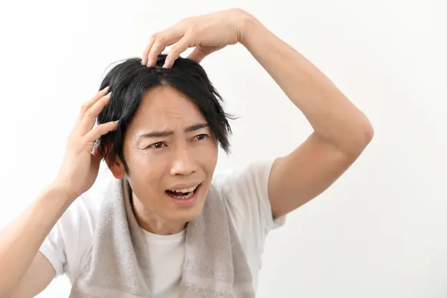 頭頂部とこめかみに手を当てて薄毛を気にする男性。FUE手術を検討中の患者像として、髪の減少に不安を抱える様子を表現