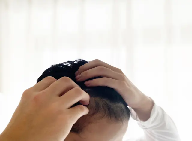薄暗い部屋で自分の頭皮にそっと手を添え、髪の感触を確かめる中年男性の後ろ姿。かつての薄毛に悩んだ記憶と、植毛によって取り戻した髪への喜びを静かに噛みしめる瞬間を表現したイメージ。自然な仕上がりの自毛植毛やFUE法の成果を象徴する情景として、薄毛改善への希望を感じさせるビジュアル。