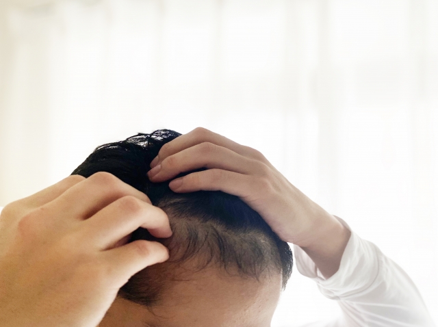 薄毛に悩んでいる男性