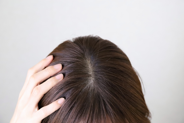 頭頂部の薄毛に悩む女性が無言で頭に手を添えて俯いている様子。自毛植毛や薄毛治療への関心を象徴するイメージカット。