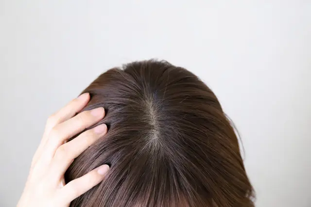 頭頂部の薄毛に悩む女性が無言で頭に手を添えて俯いている様子。自毛植毛や薄毛治療への関心を象徴するイメージカット。