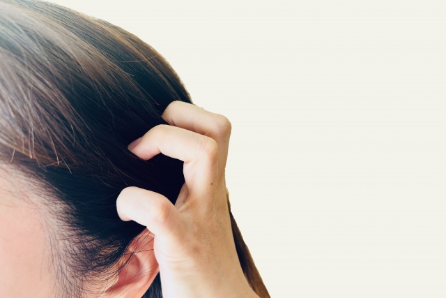 こめかみ付近の髪を指でかき分け、耳まわりと植毛後に回復したとみられる頭皮の一部が見えている様子。頭皮フラップ手術後の自然な仕上がりや、補助的に行われた自毛植毛の経過例を示唆。