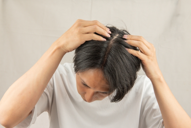 植毛後のスタイリング中に、頭皮の露出をカバーするよう髪の流れを調整している中年男性。ボリューム感を演出する術後スタイリングの工夫を表現した場面