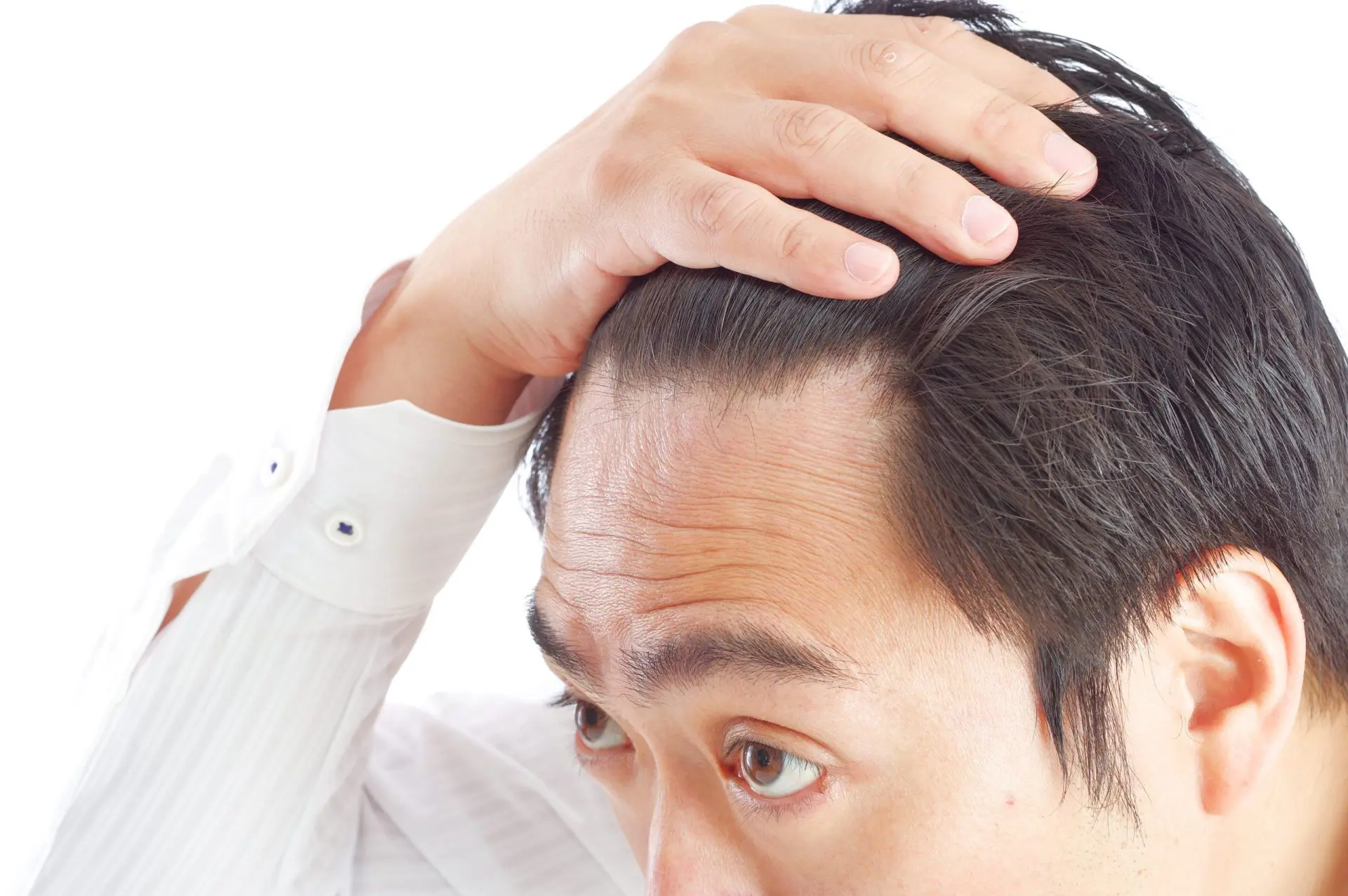 おでこを気にする男性