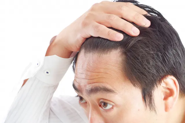 生え際を気にする男性