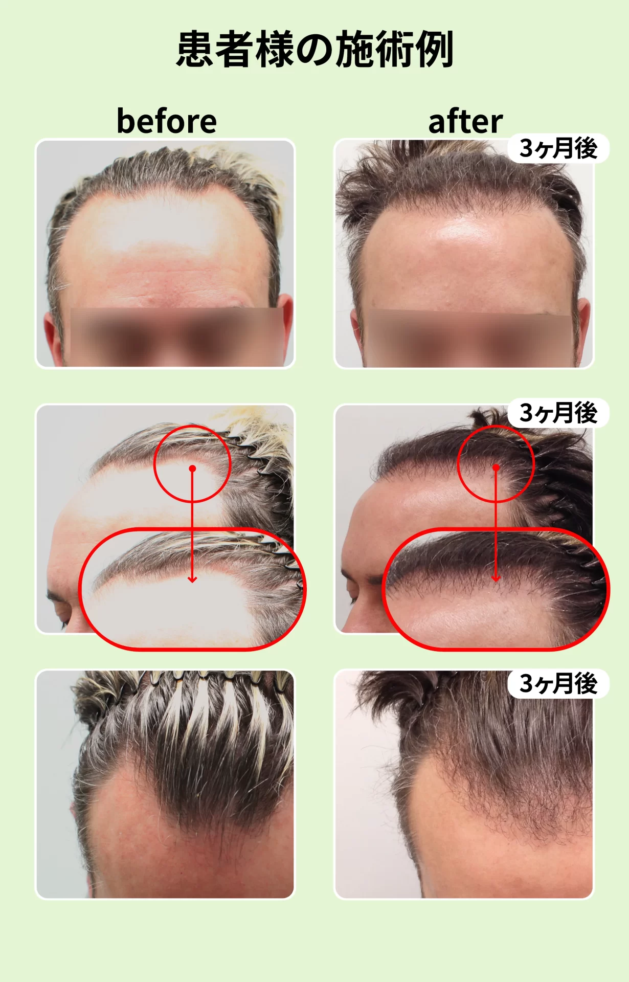 施術例