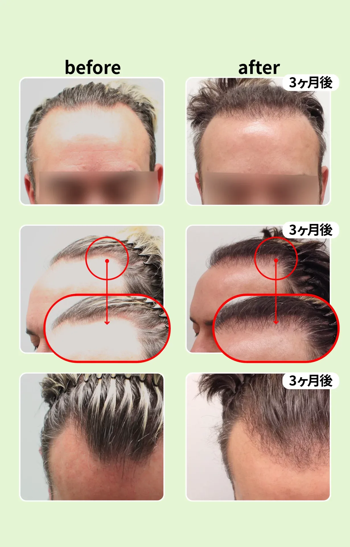 施術例
