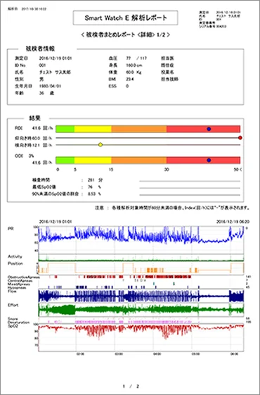 スマートウォッチPMP-300Eの解析レポート