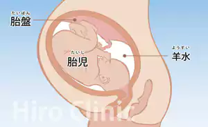 羊水検査