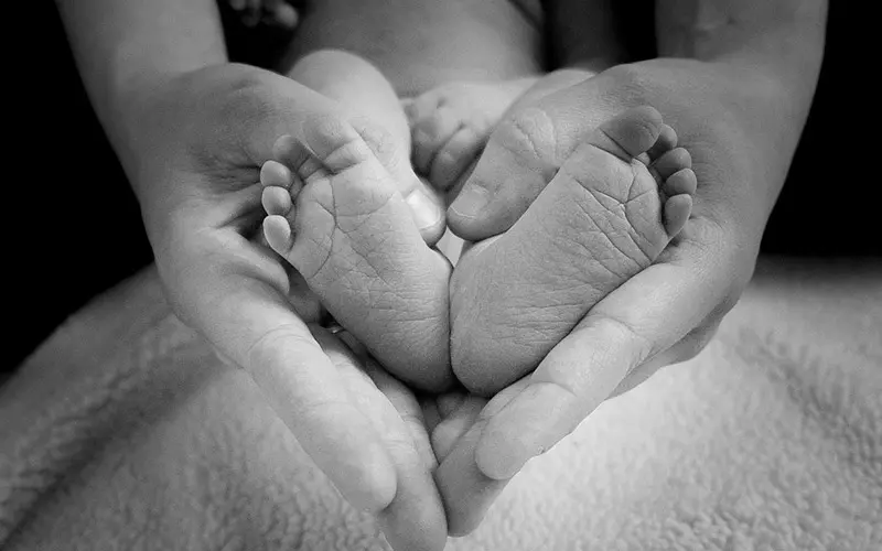 ウォルフ・ヒルシュホーン症候群とは？特徴や原因、症状　足　手　ハート　写真