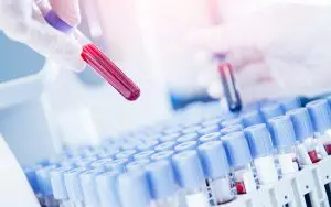 母体血清マーカーの特徴とNIPT(新型出生前診断)との比較　検査　スピッツ　写真