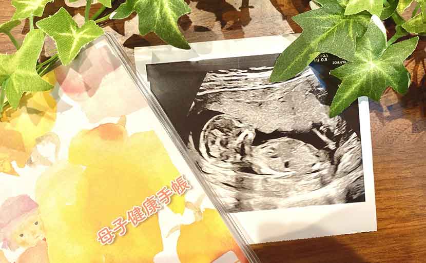 プレママになったら知っておきたい「母子手帳のもらい方」　エコー写真　母子健康手帳　写真