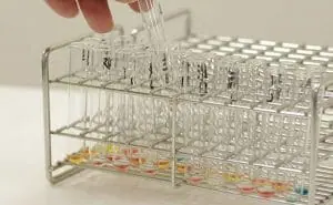  絨毛検査って何？絨毛検査の検査方法・費用・羊水検査との違いを解説　スピッツ　写真