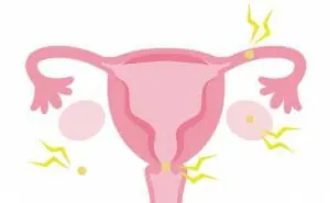 子宮外妊娠とは？