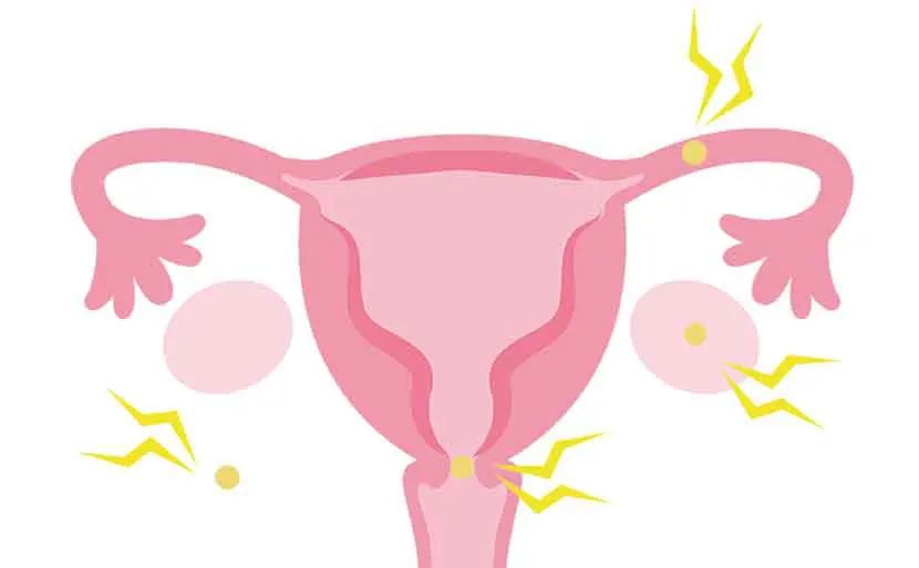 子宮外妊娠が起こる原因とは？おもな予兆と症状・治療について　子宮外妊娠　イラスト